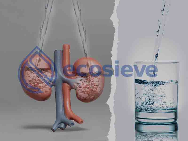 چگونه آب مصرفی می‌تواند باعث بروز سنگ کلیه شود؟